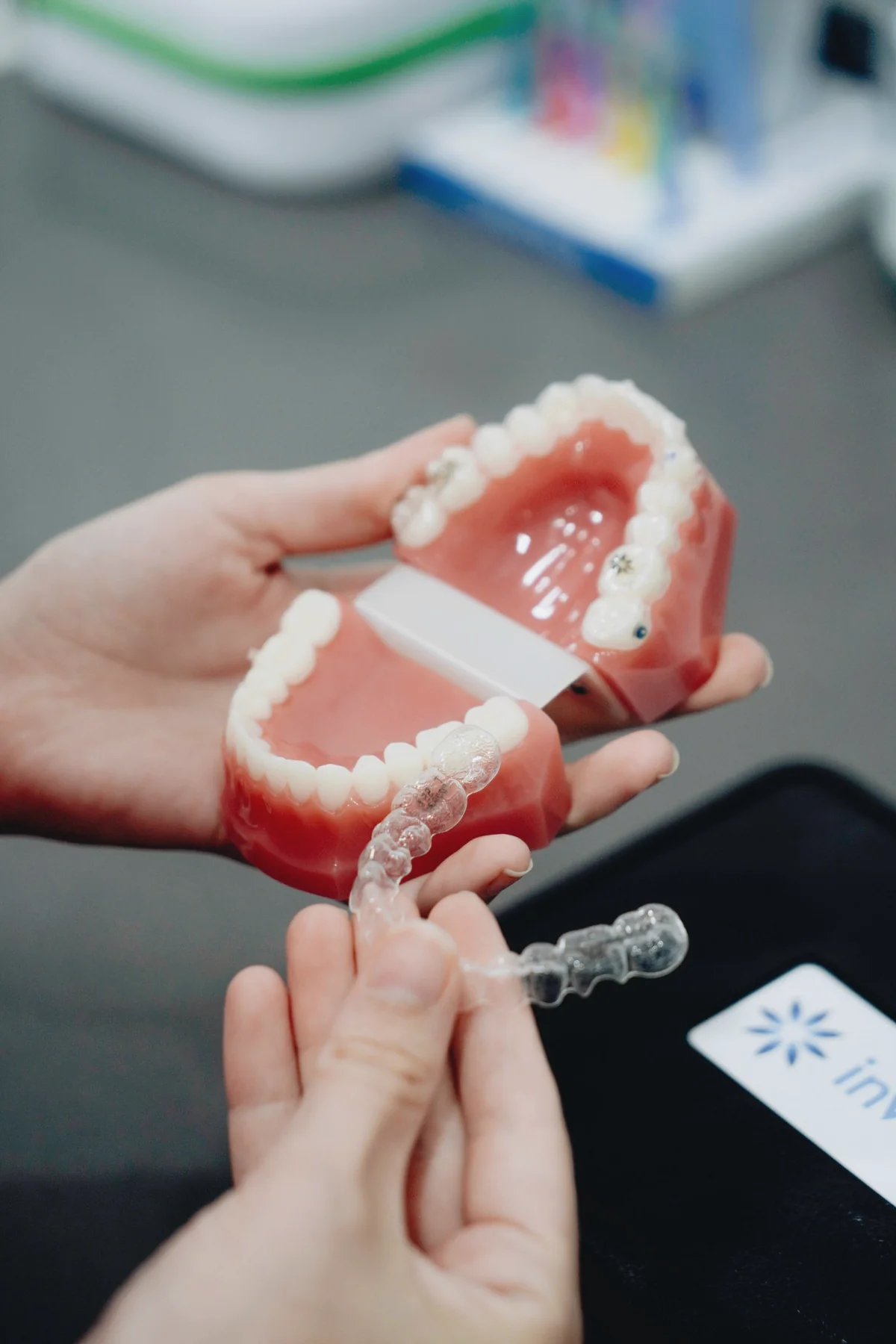 Clear dental aligner fitted over an upper-jaw model